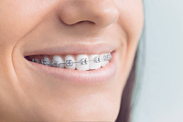 Dental X-Rays and Imaging in Lagunitas Forest Knolls, CA